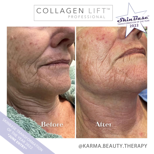 KARMABEAUTYTHERAPY June Transformations