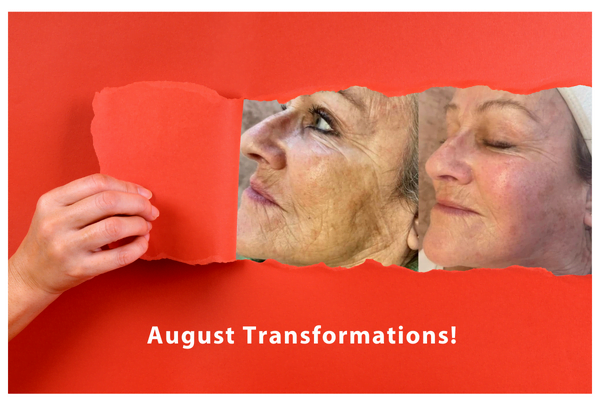 august transformations