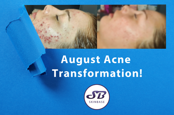 AUGUST TRANSFORMATIONS