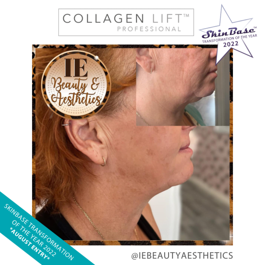 IEBEAUTYAESTHETICS IEBEAUTYAESTHETICS