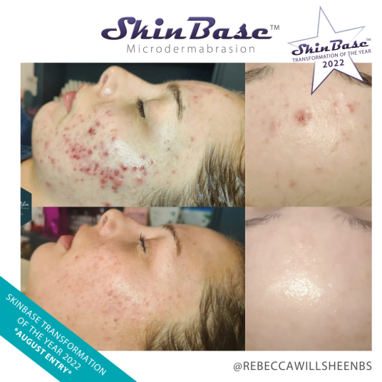REBECCAWILLSHEENBS AUGUST TRANSFORMATIONS REBECCAWILLSHEENBS AUGUST TRANSFORMATIONS