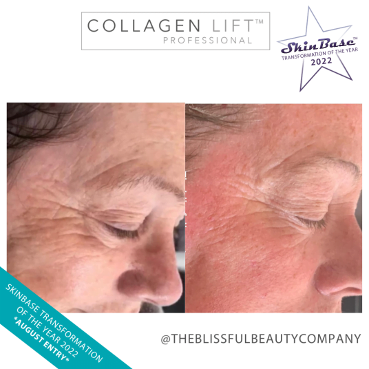 THEBLISSFULBEAUTYCOMPANY THEBLISSFULBEAUTYCOMPANY collagen lift facial transformation