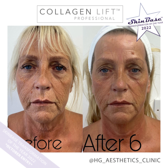 HG AESTHETICS CLINIC SKIN CONCERNS