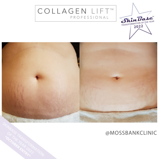 MOSSBANKCLINIC skinbase treatment MOSSBANKCLINIC skinbase treatment