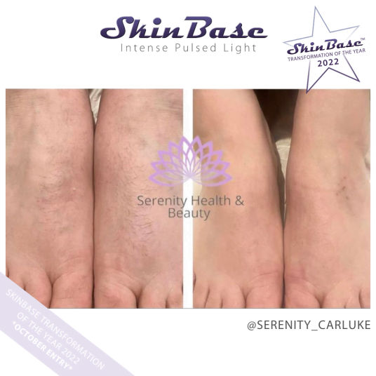 SERENITYCARLUKE SKIN CONCERNS