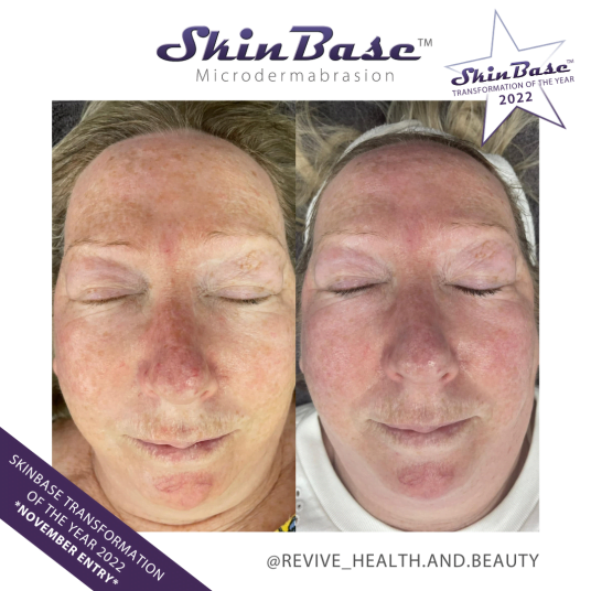 REVIVEHEALTHANDBEAUTY2 november skin