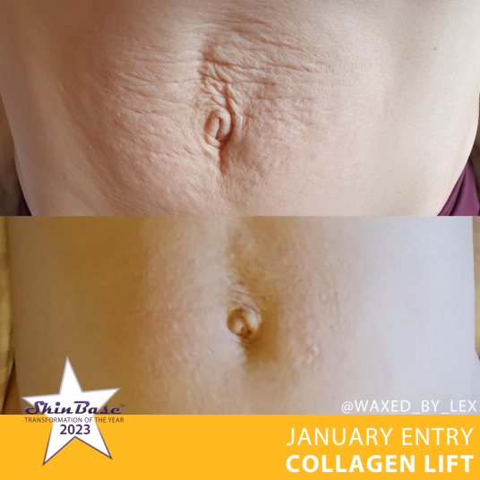 January Transformation of the Year January Transformation of the Year