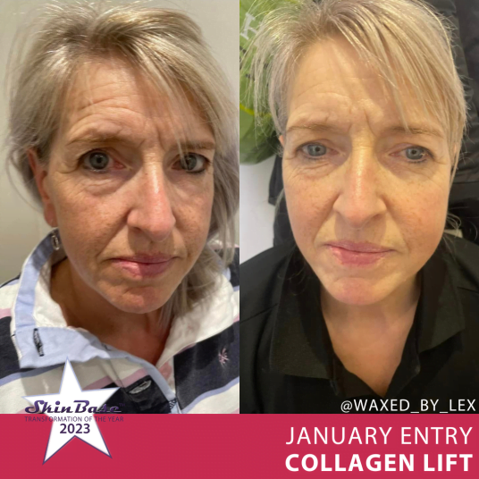 COLLAGEN LIFT TRANSFORMATIONS WAXEDBYLEX2 COLLAGEN LIFT TRANSFORMATIONS WAXEDBYLEX