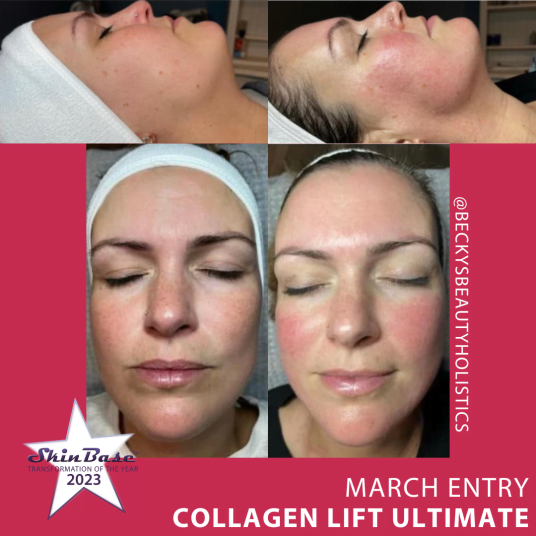 BECKYSBEAUTYHOLISTICS Collagen Lift Ultimate BECKYSBEAUTYHOLISTICS Collagen Lift Ultimate
