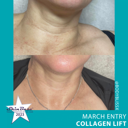 BODYBLISS BODYBLISS Collagen Lift Ultimate
