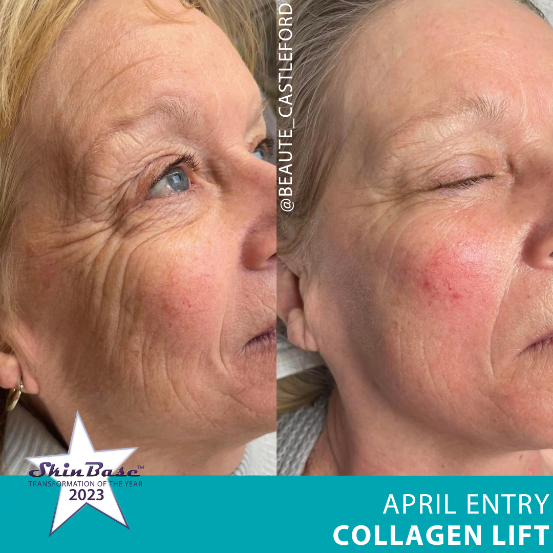 BEAUTE April vote