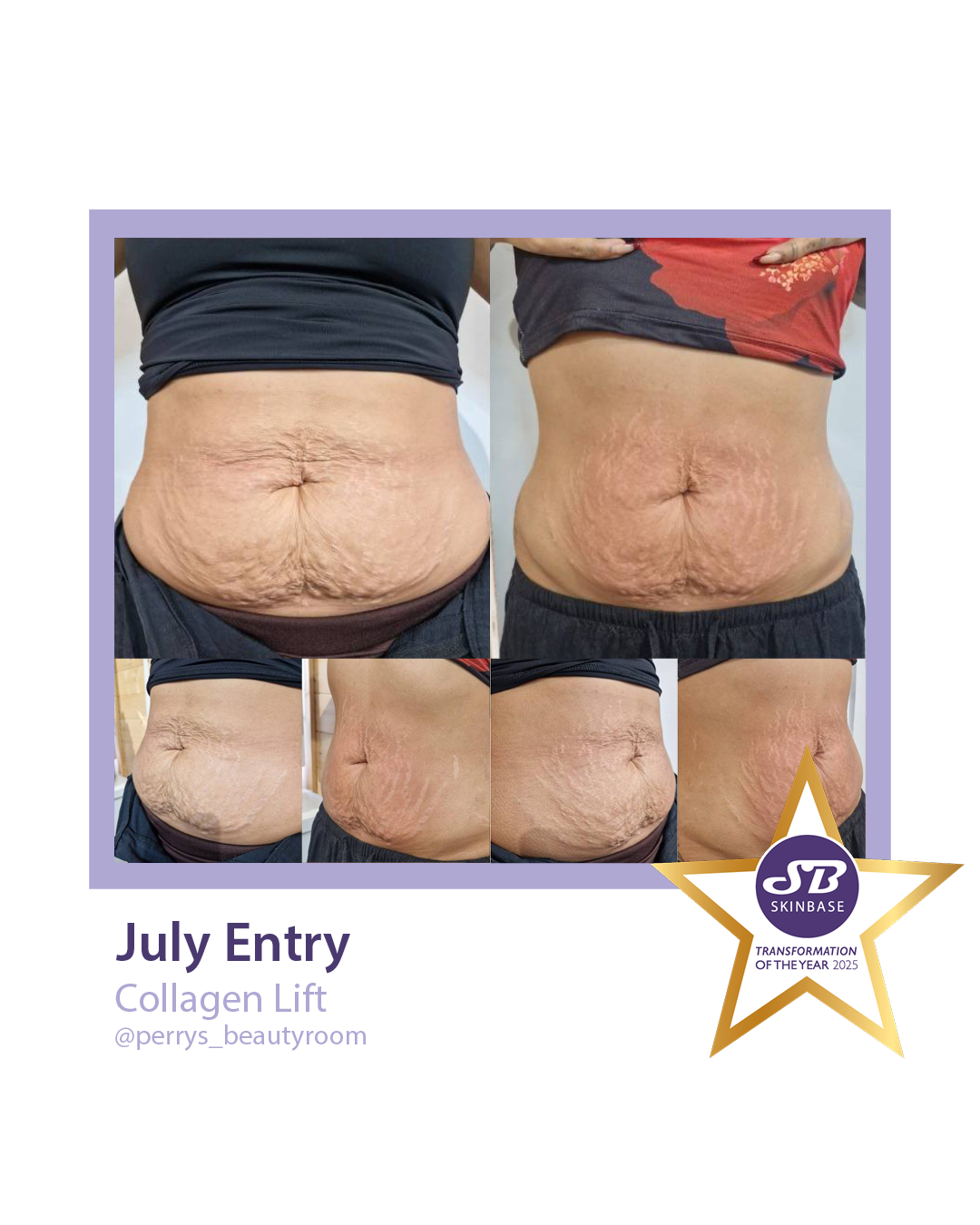 July Perry's Beauty Collagen Lift