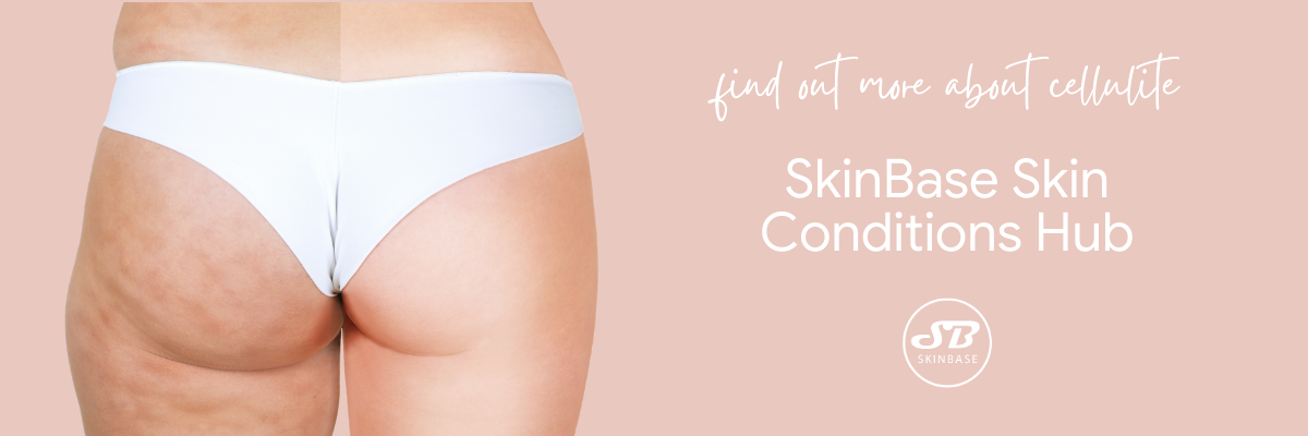 cellulite-skin-conditions-hub