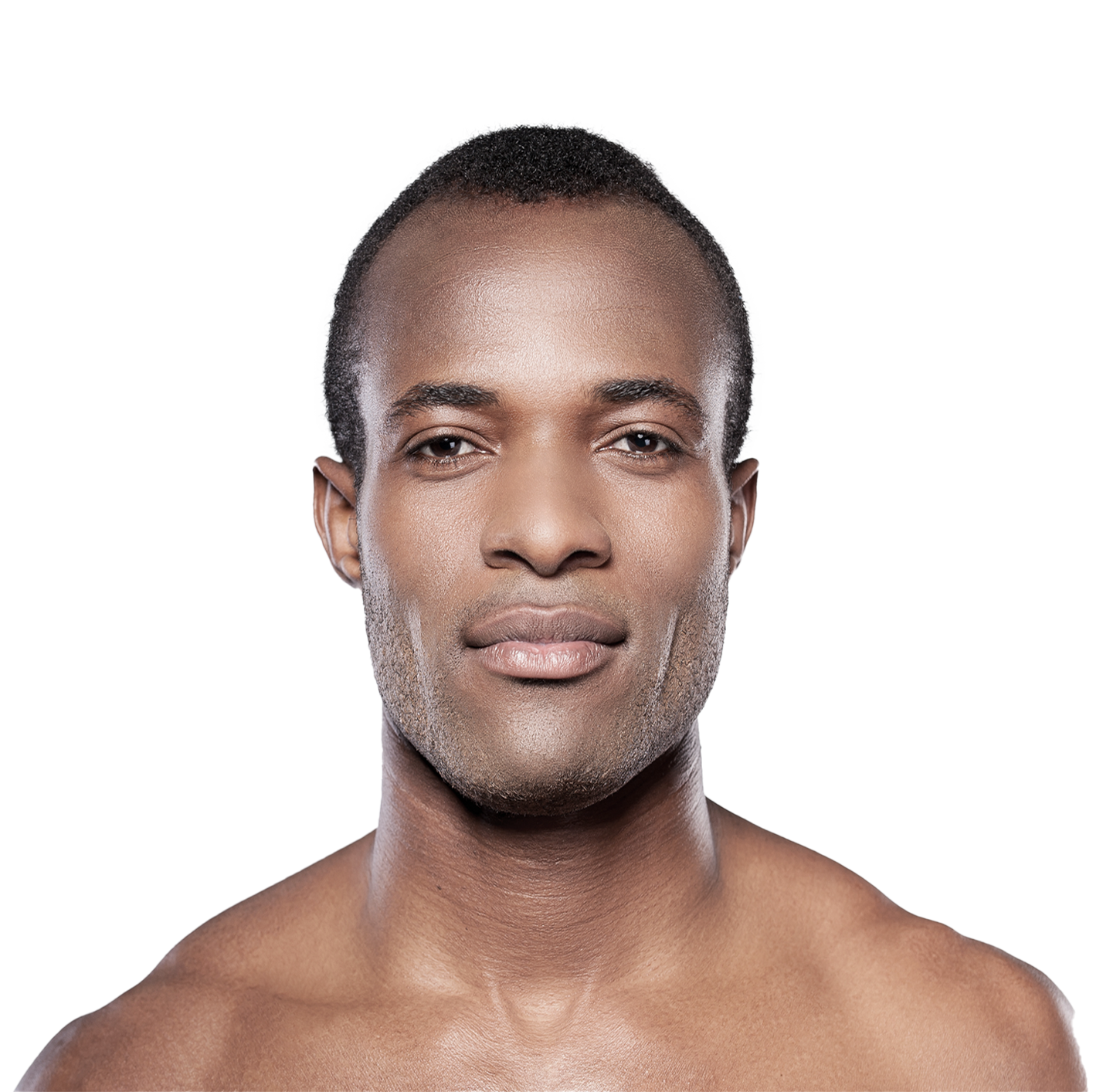 what is microdermabrasion