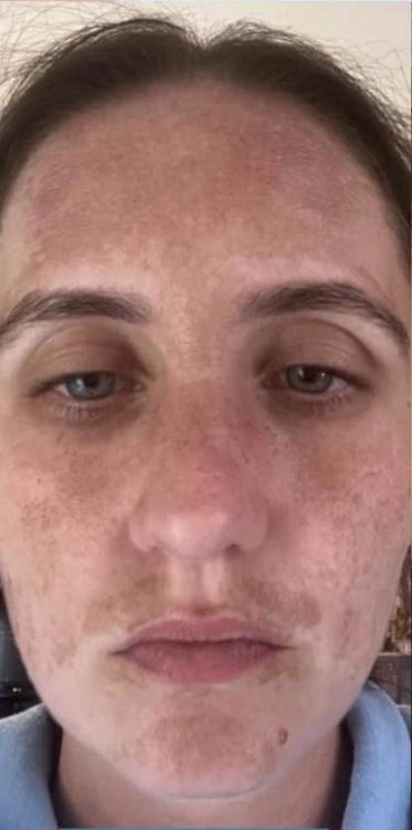 beforeandafteripl
