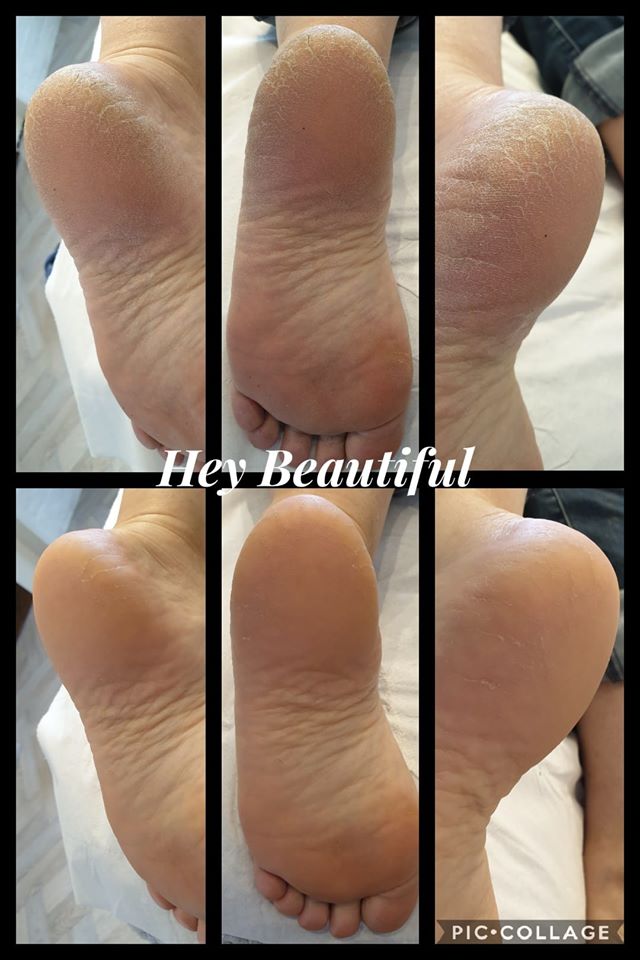pedicure