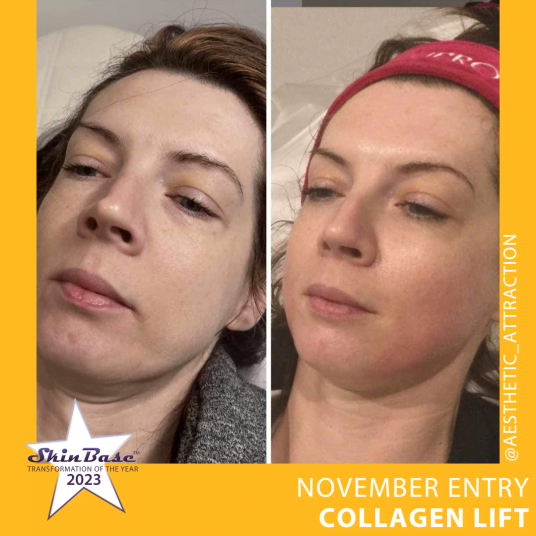 November Transformations November Transformations