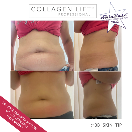 BBSKINTIP 1 BBSKINTIP BODY TRANSFORMATIONS