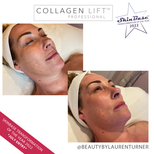 BEAUTYBYLAURENTURNER BEAUTYBYLAURENTURNER FACIAL TRANSFORMATION