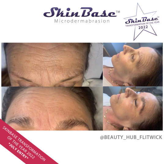 BEAUTYHUBFLITWICK FACIAL TRANSFORMATION BEAUTYHUBFLITWICK FACIAL TRANSFORMATION