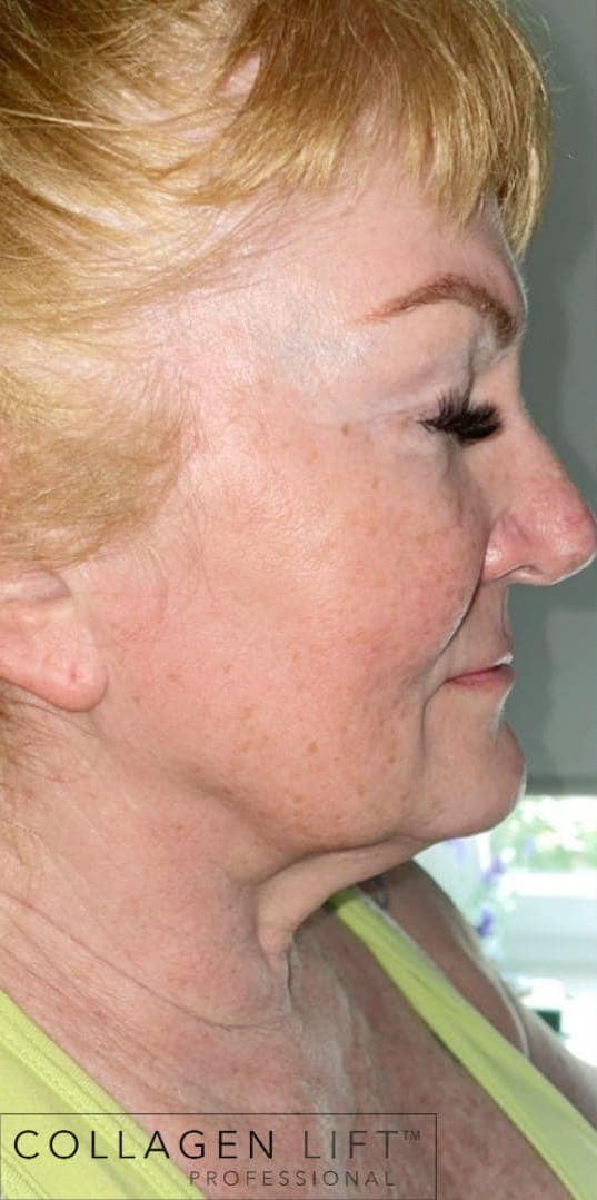 before and after collagen lift boho brow and beauty