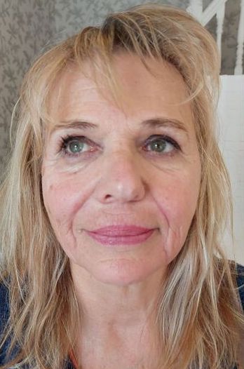 before and after collagen lift carmen's nail and beauty salon