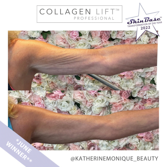 KATHERINEMONIQUEBEAUTY2 CL WINNER