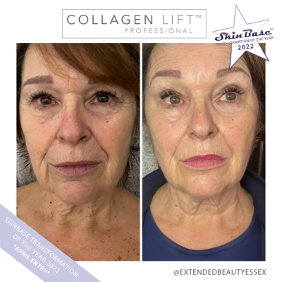 EXTENDED BEAUTY ESSEX
