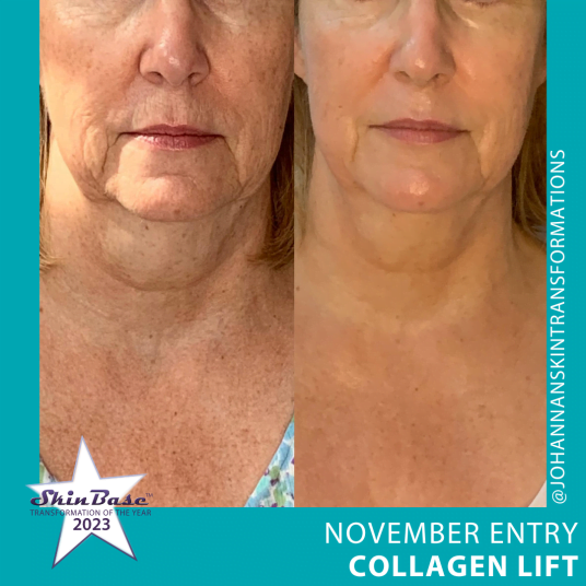 November Transformations November Transformations
