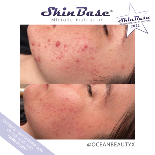 OCEANBEAUTY TRANSFORMATION OCEANBEAUTY TRANSFORMATION