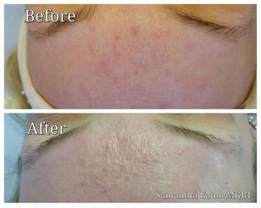 Blemishes, Samantha Eaton