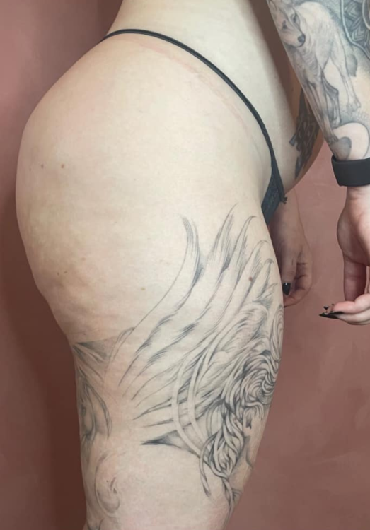 before and after collagen lift for cellulite current beauty