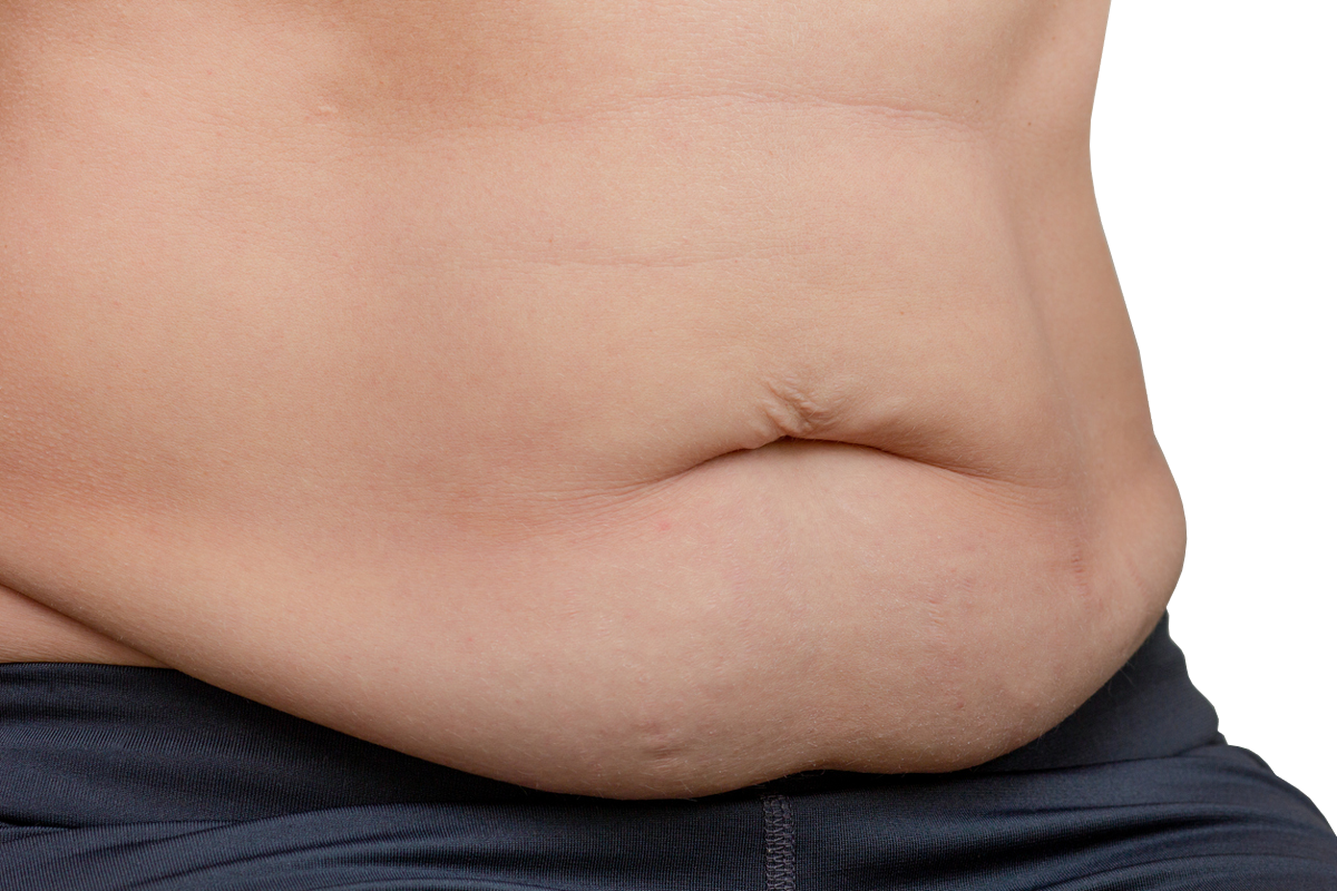 loose skin