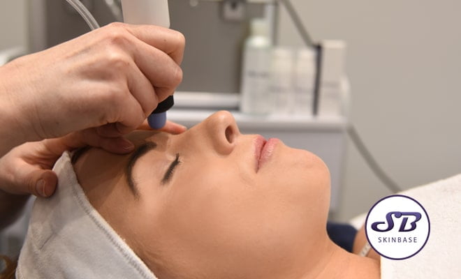 microdermabrasion for dull & tired skin
