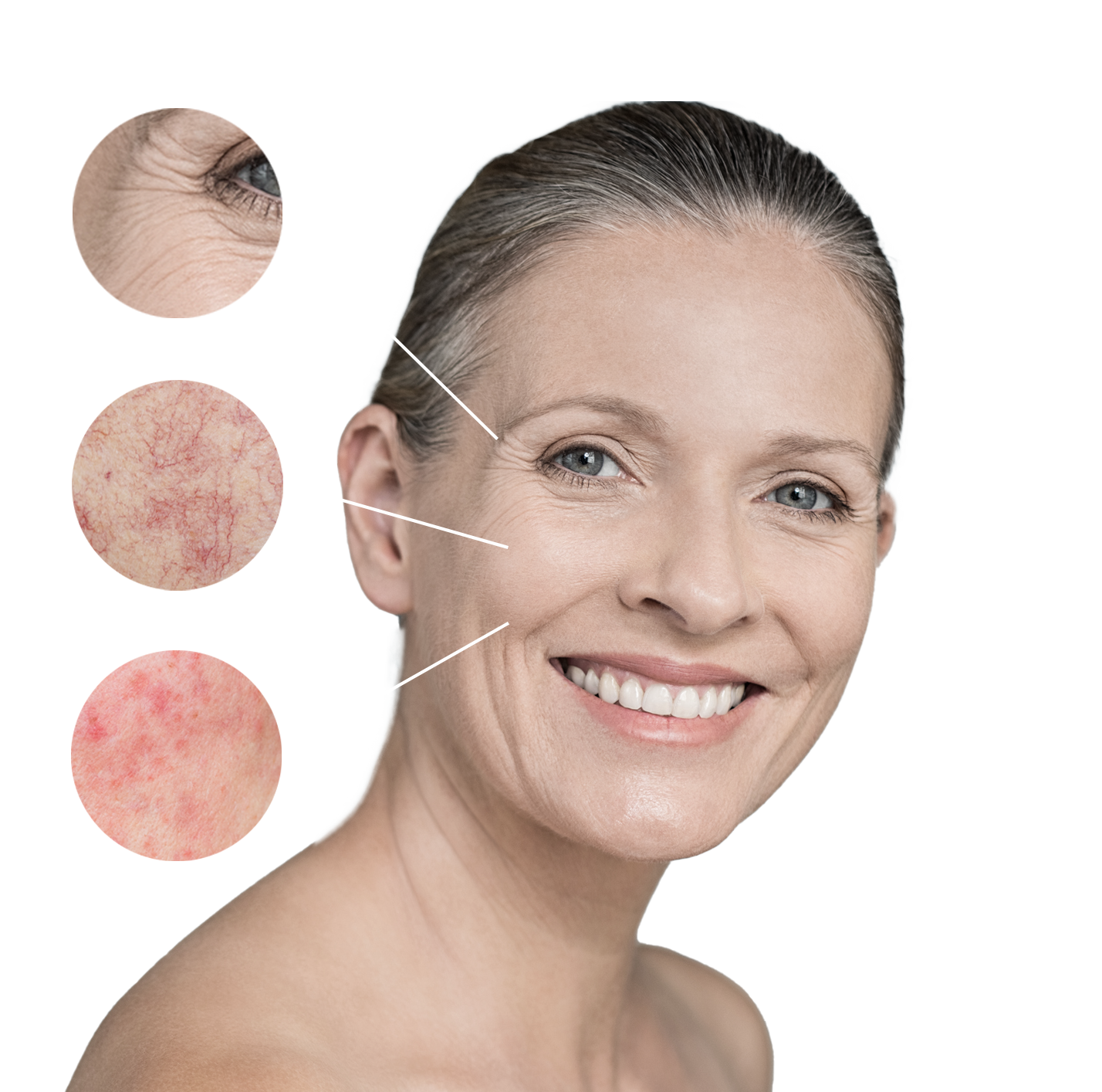 skin conditions