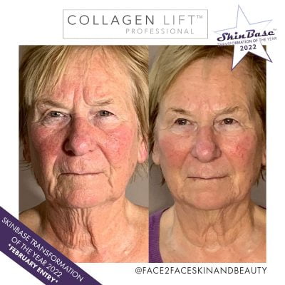 transformation-b+a-face-2-face