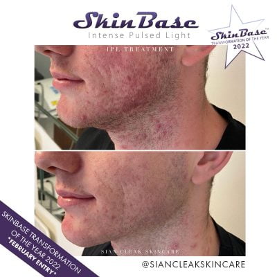 transformation-b+a-feb-sian-cleak