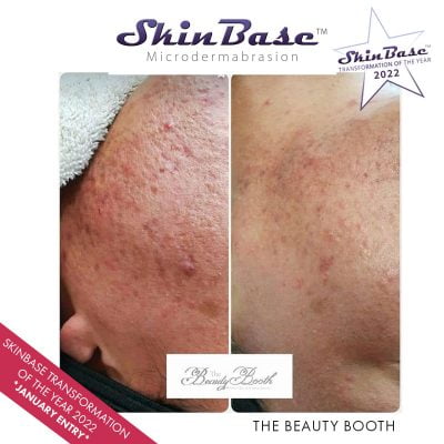 transformation-b+a-jan-beauty-booth