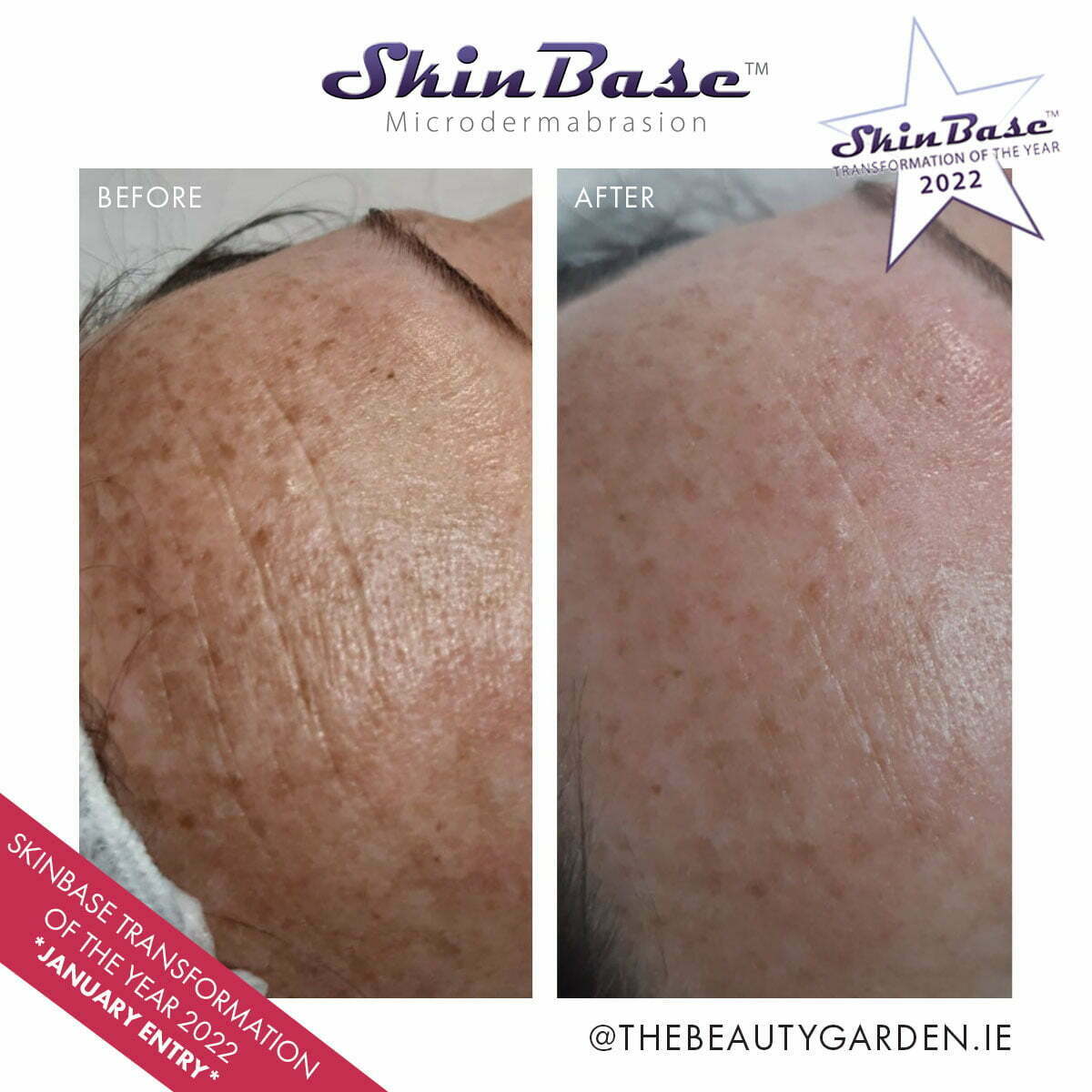 beauty garden transformation
