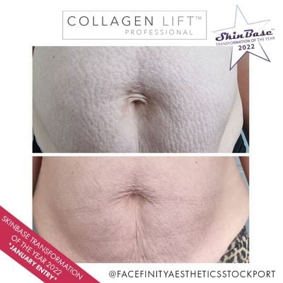 transformation-b+a-jan-facefinity-3