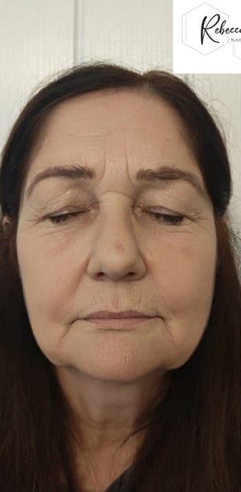 before and after collagen lift Rebecca Willshee nail and beauty specialist