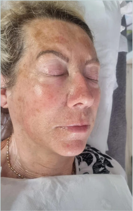 before and after hydro massage2u 2