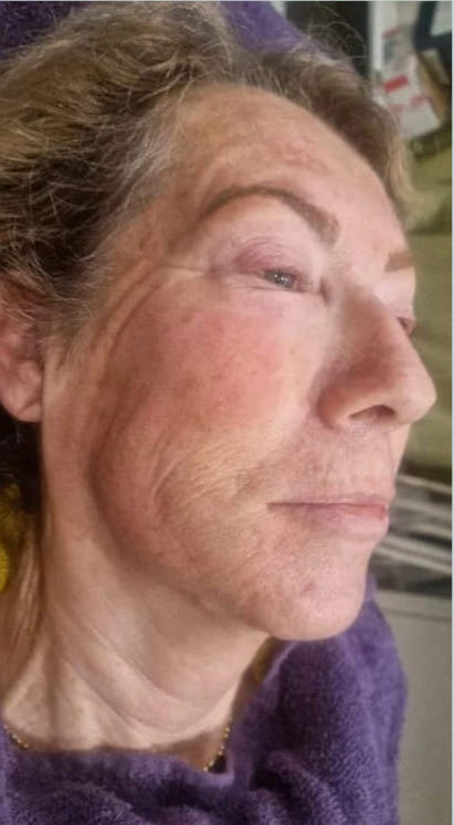 before and after hydro massage2u 1