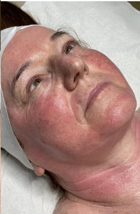 before and after collagen lift a nu u beauty and brows 2