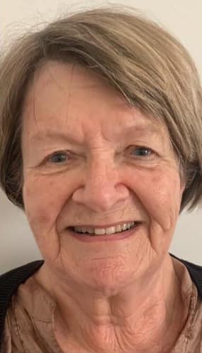 before and after collagen lift amy marsden beauty 1