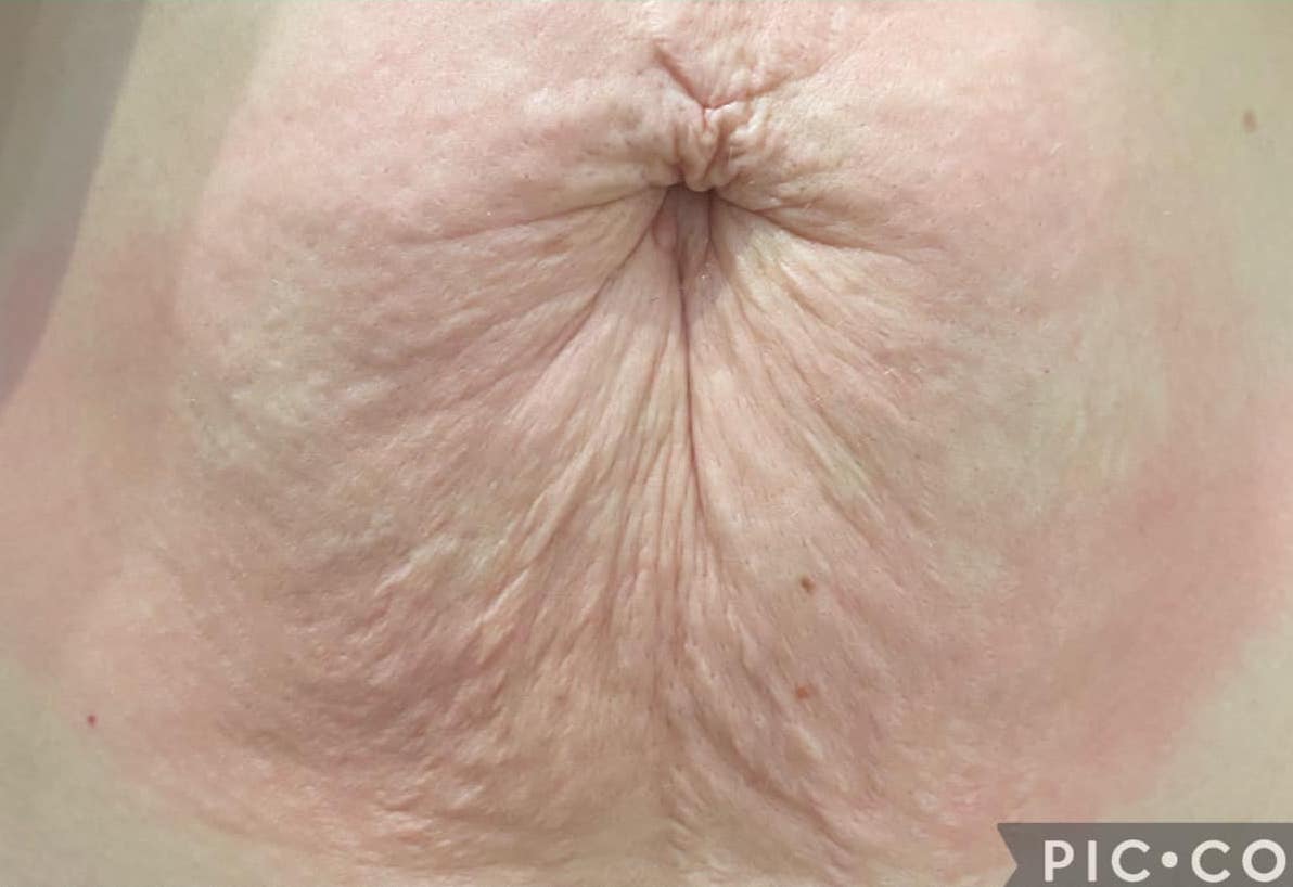 before and after collagen lift natural beauty by natalie 2
