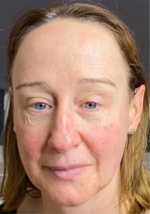 before and after collagen lift tranquility lash and beauty 1