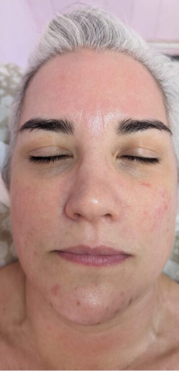 before and after hydro glam beauty education 1