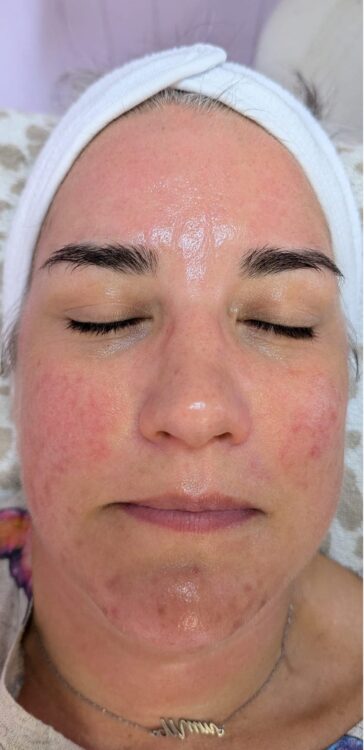 before and after hydro glam beauty education 2