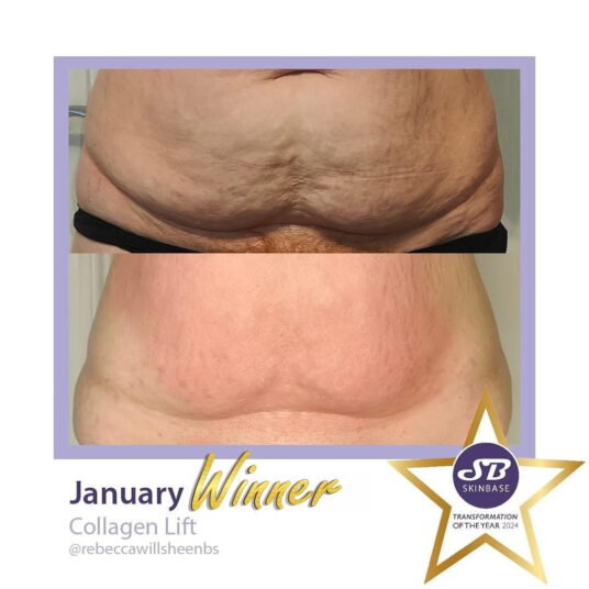 January Double Win: Rebecca Willshee January Double Win: Rebecca Willshee